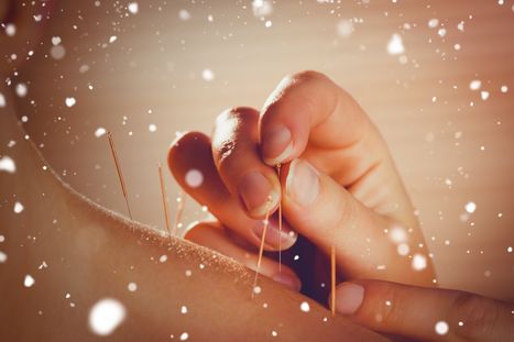 Snow against young woman getting acupuncture treatment